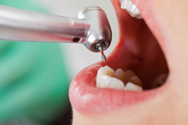 Best Emergency Treatment for Toothache in Yates Center, KS